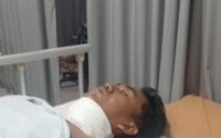 Pelajar Palembang Terluka Akibat Tali Layangan, Wali Kota Langsung Tindaklanjuti